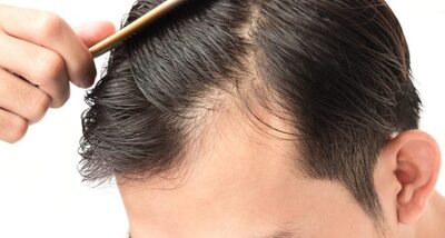 اقتصاديات استعادة الشعر: فهم التكلفة في دبي